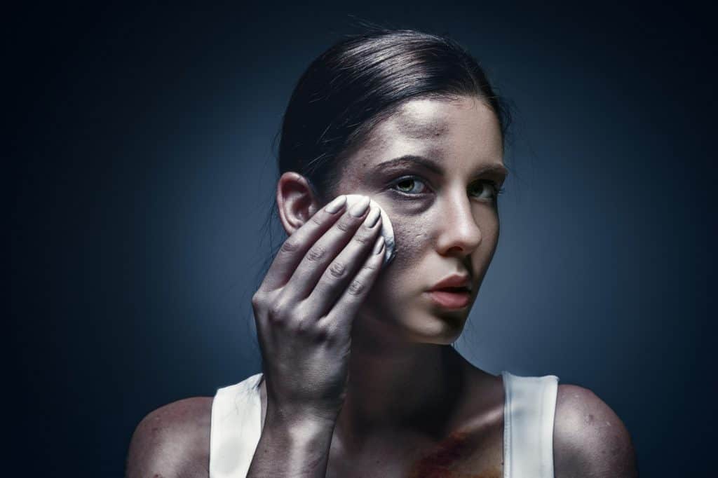 Close up portrait of a crying woman with bruised skin and black eyes